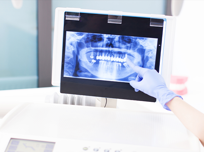 3D digital model from the intra-oral scanner on screen at South Florida Smile Spa