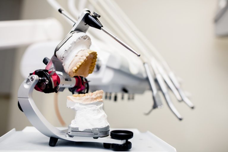 Full-mouth rehabilitation planning models at South Florida Smile Spa, Pompano Beach