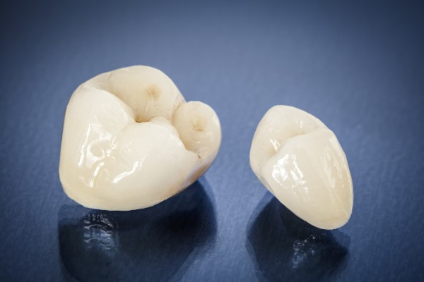 CEREC Crown  No Need For A Tradtional Impression