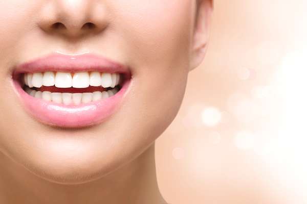 Dental Bonding vs. Contouring from South Florida Smile Spa, Nicole M. Berger, DDS in Pompano Beach, FL