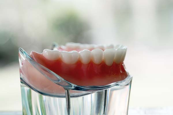 Your Dentist Can Determine If Denture Rebase Is Needed