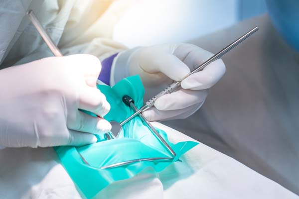 When A Cracked Tooth Is A Dental Emergency