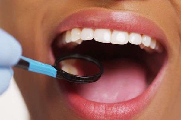 How A General Dentist Treats Cavities