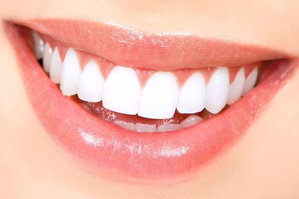 How Long Does Teeth Whitening Take from South Florida Smile Spa, Nicole M. Berger, DDS in Pompano Beach, FL