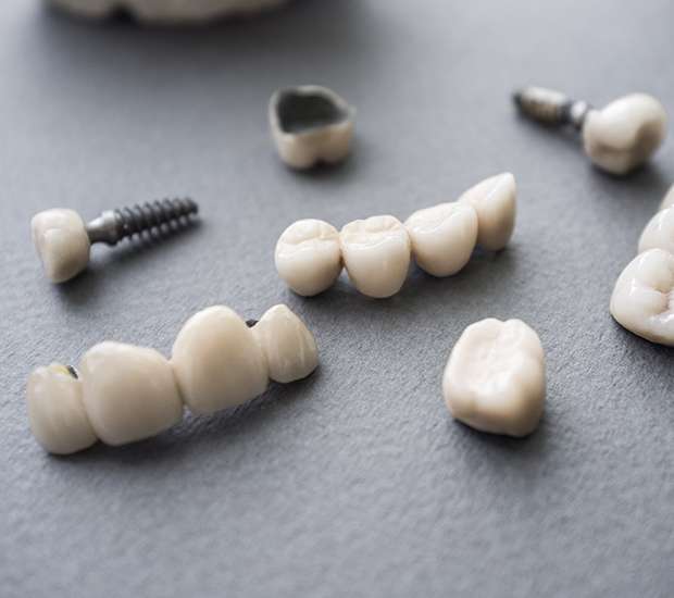 Pompano Beach The Difference Between Dental Implants and Mini Dental Implants
