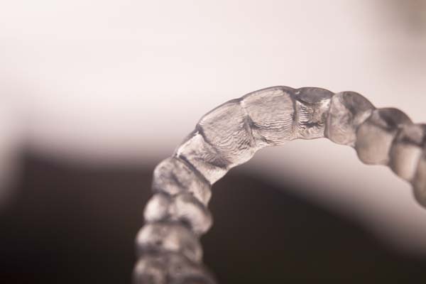 Comparing The Invisalign Process With Traditional Braces