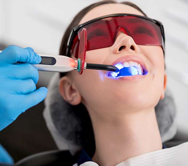 Pompano Beach Professional Teeth Whitening