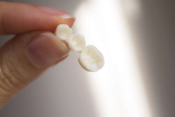 Replace Missing Teeth with Dental Bridges from South Florida Smile Spa, Nicole M. Berger, DDS in Pompano Beach, FL