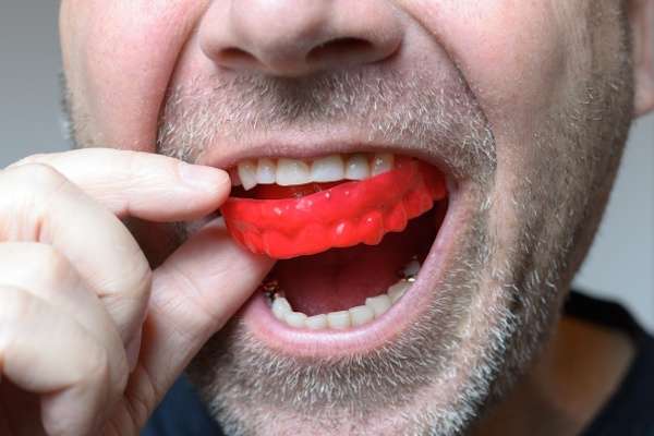 Save Your Teeth by Wearing Mouth Guards at Night from South Florida Smile Spa, Nicole M. Berger, DDS in Pompano Beach, FL