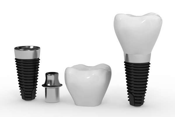 What Are the Parts of Dental Implants from South Florida Smile Spa, Nicole M. Berger, DDS in Pompano Beach, FL